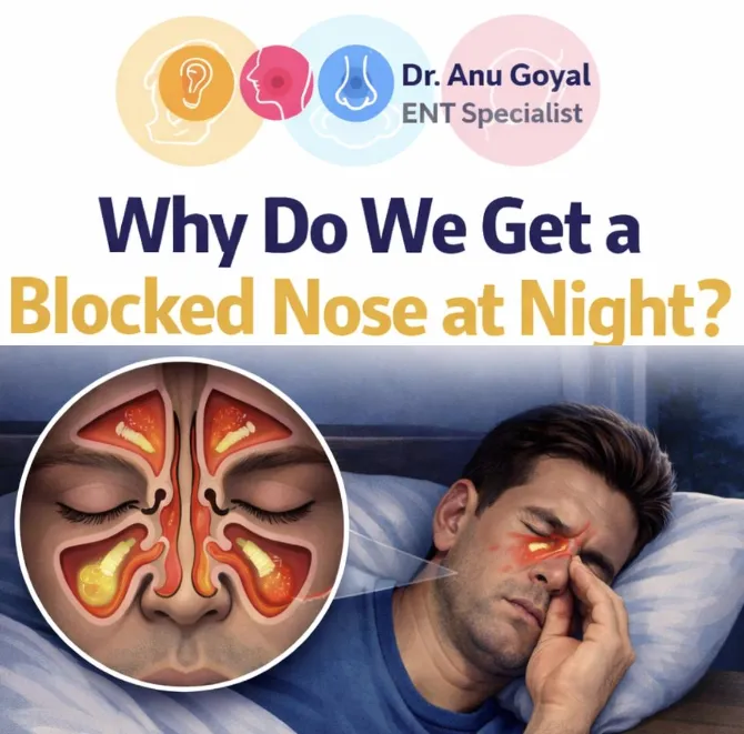 Why Do We Get a Blocked Nose At Night - Dr. Anu Goyal